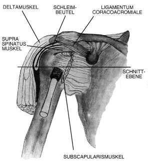 schulter02