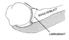 schulter lux 02